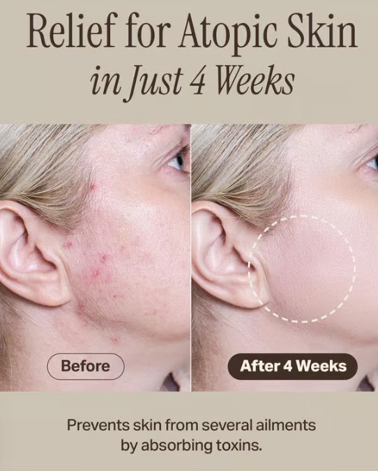 Mud Mask - Deep Cleansing & Hydrating with Boryeong Mud